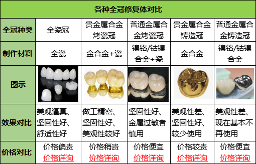 烤瓷牙的價格區間範圍